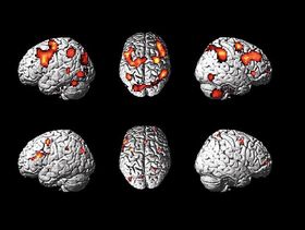 'Artificial brain' only 10 years away
